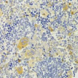 Anti-DPP3 antibody used in IHC (Paraffin sections) (IHC-P). GTX33164