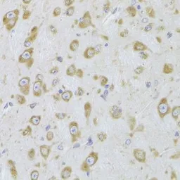 Anti-EEF1B2 antibody used in IHC (Paraffin sections) (IHC-P). GTX33169