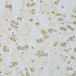 Anti-EEF1B2 antibody used in IHC (Paraffin sections) (IHC-P). GTX33169