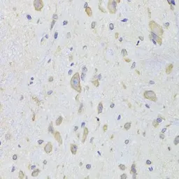 Anti-EEF1B2 antibody used in IHC (Paraffin sections) (IHC-P). GTX33169
