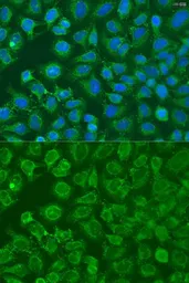 Anti-EIF2B1 antibody used in Immunocytochemistry/ Immunofluorescence (ICC/IF). GTX33172