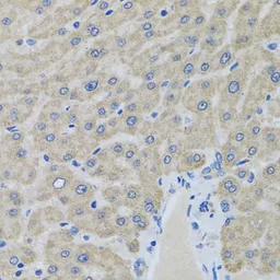 Anti-EIF2S3 antibody used in IHC (Paraffin sections) (IHC-P). GTX33173
