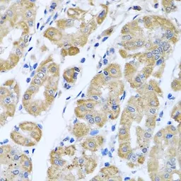 Anti-EIF2S3 antibody used in IHC (Paraffin sections) (IHC-P). GTX33173