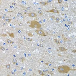 Anti-EIF2S3 antibody used in IHC (Paraffin sections) (IHC-P). GTX33173