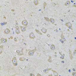 Anti-EIF3F antibody used in IHC (Paraffin sections) (IHC-P). GTX33174