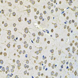 Anti-EIF3F antibody used in IHC (Paraffin sections) (IHC-P). GTX33174