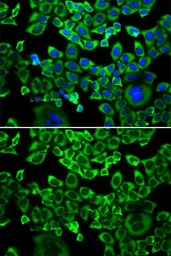 Anti-eIF4B antibody used in Immunocytochemistry/ Immunofluorescence (ICC/IF). GTX33175