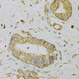 Anti-eIF4B antibody used in IHC (Paraffin sections) (IHC-P). GTX33175
