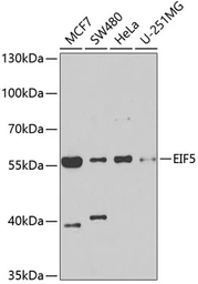 Anti-EIF5 antibody used in Western Blot (WB). GTX33176