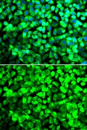 Anti-EIF5 antibody used in Immunocytochemistry/ Immunofluorescence (ICC/IF). GTX33176
