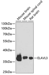 Anti-HuC antibody used in Western Blot (WB). GTX33177