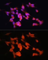 Anti-HuC antibody used in Immunocytochemistry/ Immunofluorescence (ICC/IF). GTX33177