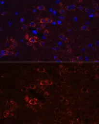 Anti-HuC antibody used in IHC (Paraffin sections) (IHC-P). GTX33177