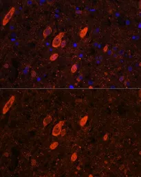 Anti-HuC antibody used in IHC (Paraffin sections) (IHC-P). GTX33177