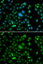 Anti-ELF5 antibody used in Immunocytochemistry/ Immunofluorescence (ICC/IF). GTX33178