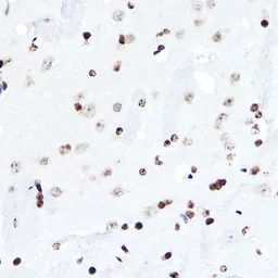 Anti-ELF5 antibody used in IHC (Paraffin sections) (IHC-P). GTX33178