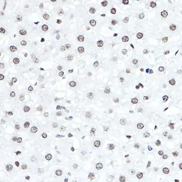 Anti-ELF5 antibody used in IHC (Paraffin sections) (IHC-P). GTX33178