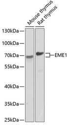 Anti-EME1 antibody used in Western Blot (WB). GTX33179
