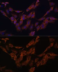 Anti-ENOX2 antibody used in Immunocytochemistry/ Immunofluorescence (ICC/IF). GTX33180