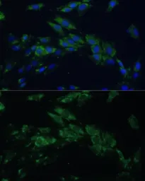 Anti-EphA4 antibody used in Immunocytochemistry/ Immunofluorescence (ICC/IF). GTX33182