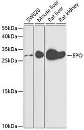 Anti-EPO antibody used in Western Blot (WB). GTX33183