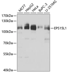 Anti-EPS15R antibody used in Western Blot (WB). GTX33184