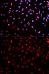 Anti-ERCC1 antibody used in Immunocytochemistry/ Immunofluorescence (ICC/IF). GTX33185