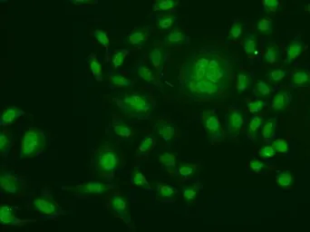Anti-ERCC1 antibody used in Immunocytochemistry/ Immunofluorescence (ICC/IF). GTX33185