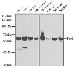 Anti-EYA3 antibody used in Western Blot (WB). GTX33187