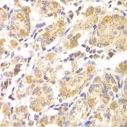 Anti-EYA3 antibody used in IHC (Paraffin sections) (IHC-P). GTX33187