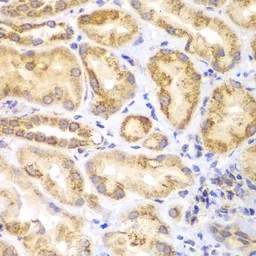 Anti-EYA3 antibody used in IHC (Paraffin sections) (IHC-P). GTX33187