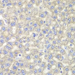 Anti-EYA3 antibody used in IHC (Paraffin sections) (IHC-P). GTX33187