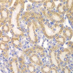 Anti-EYA3 antibody used in IHC (Paraffin sections) (IHC-P). GTX33187