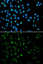 Anti-EZH1 antibody used in Immunocytochemistry/ Immunofluorescence (ICC/IF). GTX33188