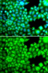 Anti-FABP3 antibody used in Immunocytochemistry/ Immunofluorescence (ICC/IF). GTX33190