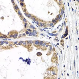 Anti-FABP3 antibody used in IHC (Paraffin sections) (IHC-P). GTX33190