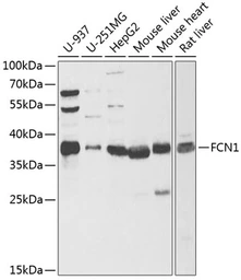 Anti-FCN1 antibody used in Western Blot (WB). GTX33195