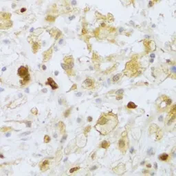 Anti-FCN1 antibody used in IHC (Paraffin sections) (IHC-P). GTX33195