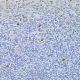 Anti-FCN1 antibody used in IHC (Paraffin sections) (IHC-P). GTX33195