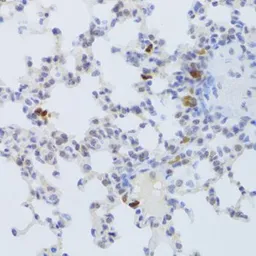 Anti-FCN1 antibody used in IHC (Paraffin sections) (IHC-P). GTX33195