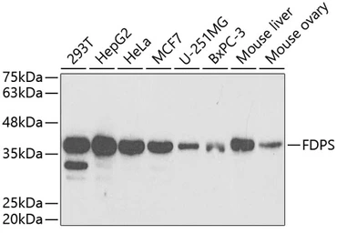 Anti-FDPS antibody used in Western Blot (WB). GTX33196
