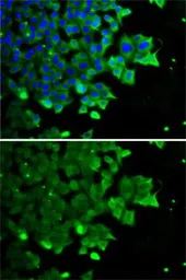 Anti-FDPS antibody used in Immunocytochemistry/ Immunofluorescence (ICC/IF). GTX33196