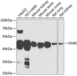 Anti-Ferredoxin Reductase antibody used in Western Blot (WB). GTX33197