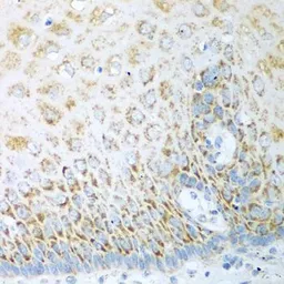 Anti-Ferredoxin Reductase antibody used in IHC (Paraffin sections) (IHC-P). GTX33197