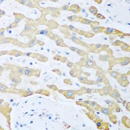 Anti-Ferredoxin Reductase antibody used in IHC (Paraffin sections) (IHC-P). GTX33197