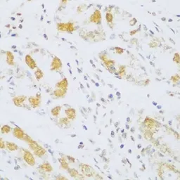 Anti-Ferredoxin Reductase antibody used in IHC (Paraffin sections) (IHC-P). GTX33197