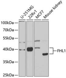 Anti-FHL1 antibody used in Western Blot (WB). GTX33199