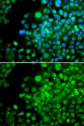 Anti-FHL1 antibody used in Immunocytochemistry/ Immunofluorescence (ICC/IF). GTX33199