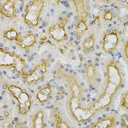 Anti-FHL1 antibody used in IHC (Paraffin sections) (IHC-P). GTX33199