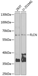 Anti-FLCN antibody used in Western Blot (WB). GTX33200